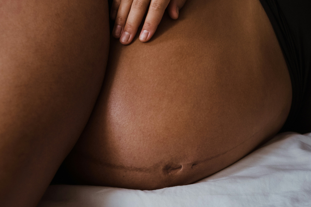 Linea negra: Woher kommt die dunkle Linie am Babybauch?